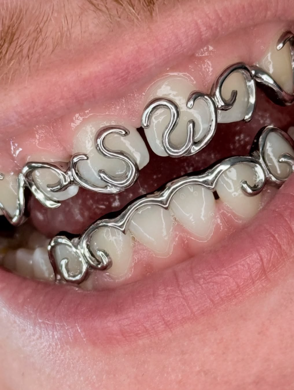 Monkey Grillz Custom Piece 4