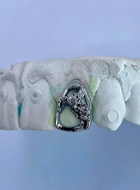 Monkey Grillz Custom Piece 6